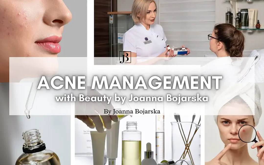 ACNE Management - blog cover - Joanna Bojarska Beauty Expert