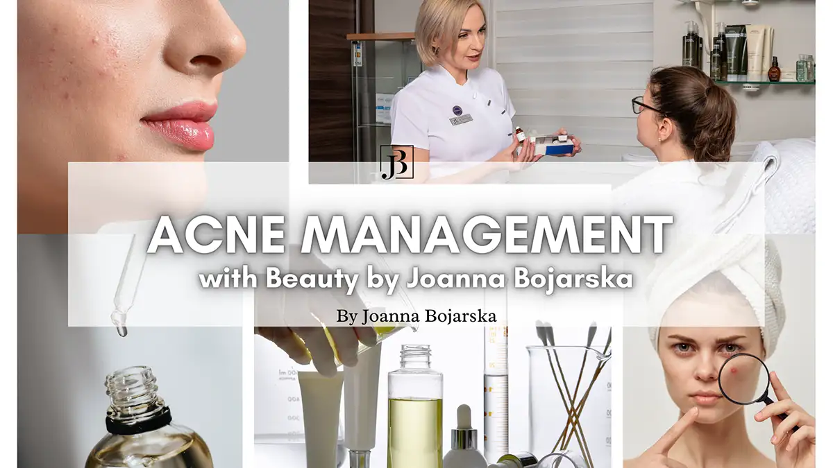 ACNE Management - blog cover - Joanna Bojarska Beauty Expert