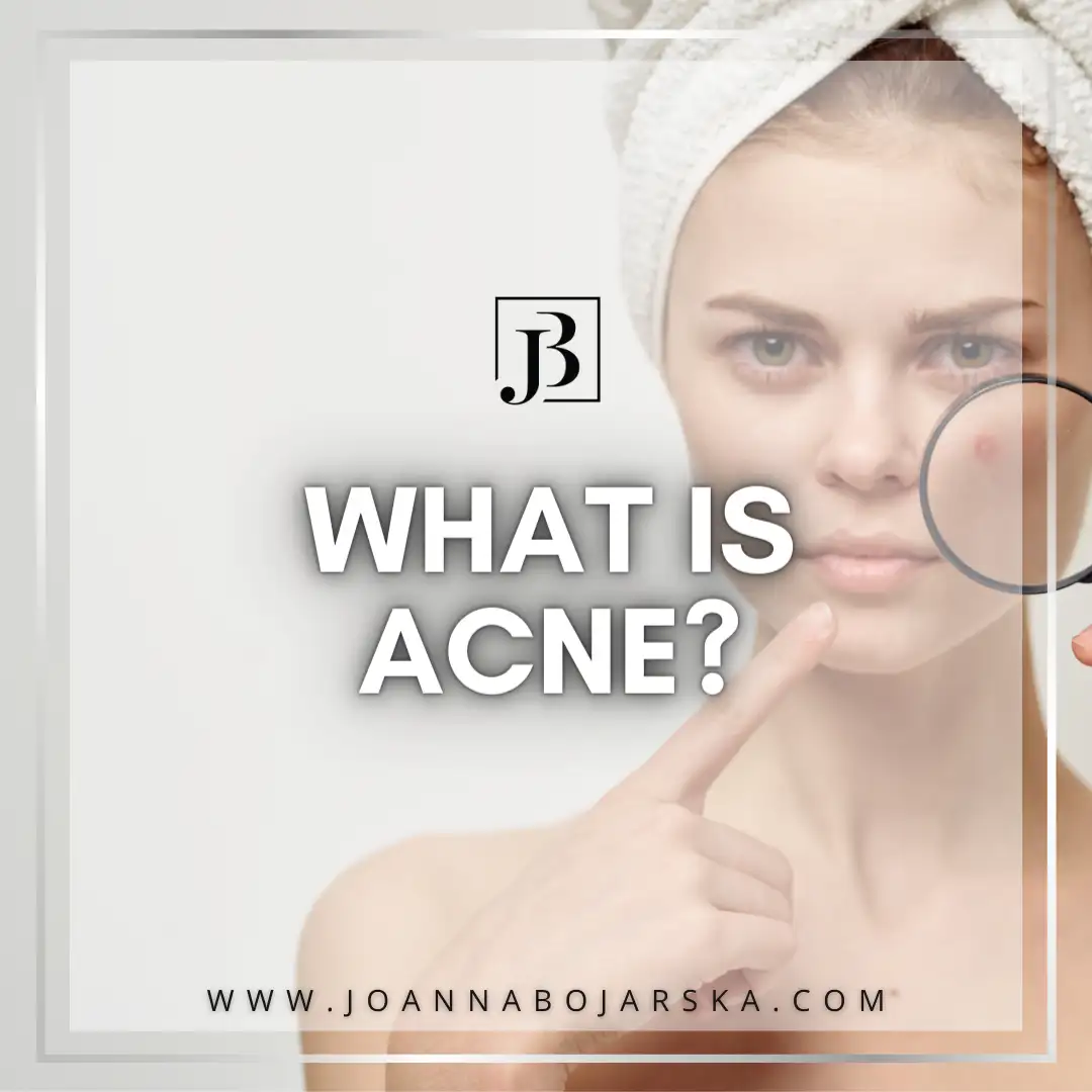 ACNE Management - Photo 1 - Joanna Bojarska Beauty Expert