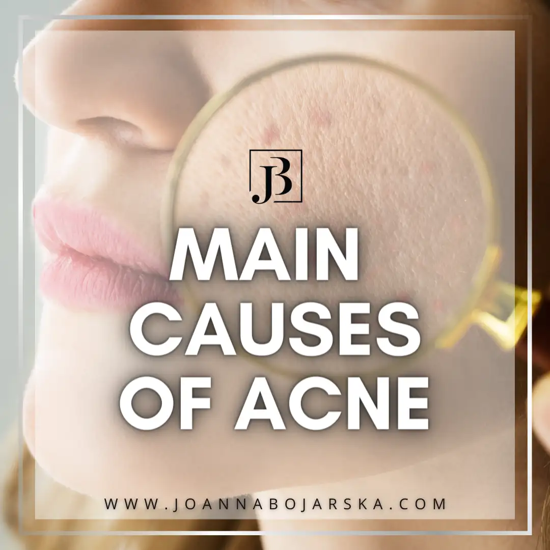 ACNE Management - Photo 2 - Joanna Bojarska Beauty Expert